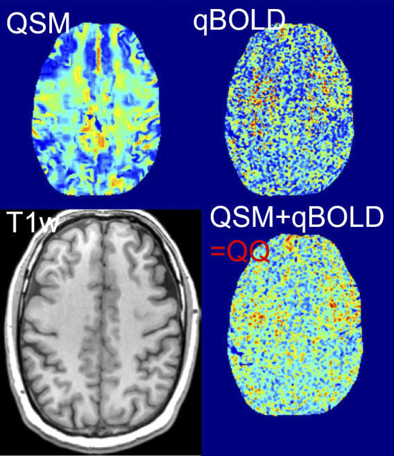 Biophysics modeling showing QSM, qBOLD, T1w, and QSM+qBOLD=QQ brain imaging techniques